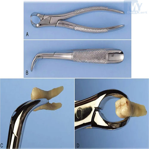 forcep 87s