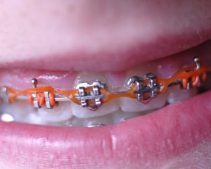 GDC E Chains