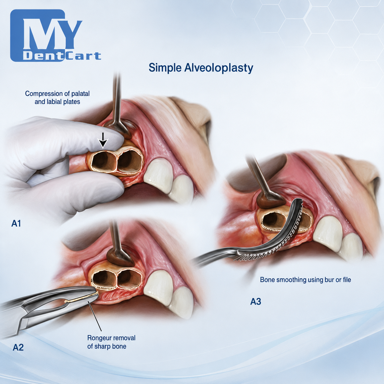 GDC Oral Surgery Impaction Kit set of 22 Pcs